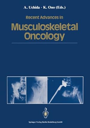 Seller image for Recent Advances in Musculoskeletal Oncology for sale by BuchWeltWeit Ludwig Meier e.K.