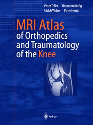 Seller image for MRI Atlas of Orthopedics and Traumatology of the Knee for sale by BuchWeltWeit Ludwig Meier e.K.