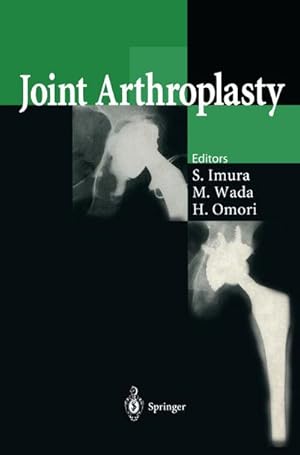 Seller image for Joint Arthroplasty for sale by BuchWeltWeit Ludwig Meier e.K.