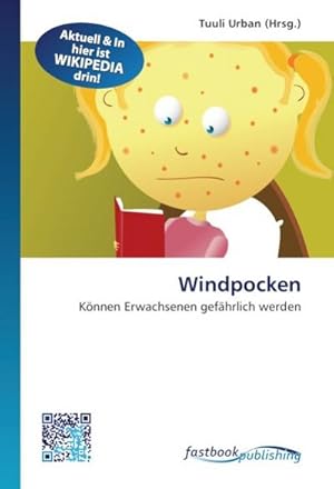 Seller image for Windpocken for sale by BuchWeltWeit Ludwig Meier e.K.