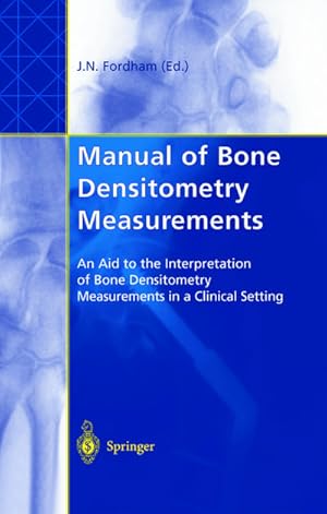 Image du vendeur pour Manual of Bone Densitometry Measurements mis en vente par BuchWeltWeit Ludwig Meier e.K.