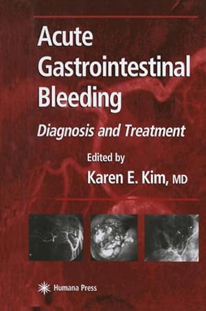 Bild des Verkufers fr Acute Gastrointestinal Bleeding zum Verkauf von BuchWeltWeit Ludwig Meier e.K.