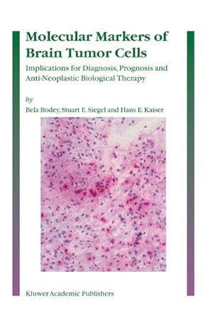 Seller image for Molecular Markers of Brain Tumor Cells for sale by BuchWeltWeit Ludwig Meier e.K.