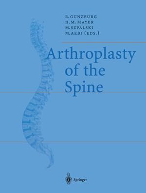 Bild des Verkufers fr Arthroplasty of the Spine zum Verkauf von BuchWeltWeit Ludwig Meier e.K.