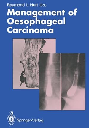 Image du vendeur pour Management of Oesophageal Carcinoma mis en vente par BuchWeltWeit Ludwig Meier e.K.