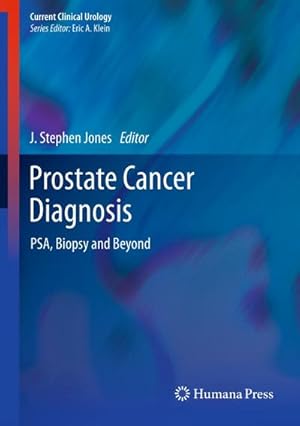 Seller image for Prostate Cancer Diagnosis for sale by BuchWeltWeit Ludwig Meier e.K.