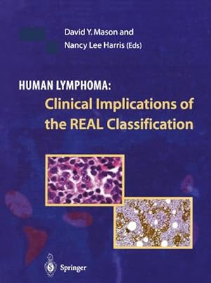 Seller image for Human Lymphoma: Clinical Implications of the REAL Classification for sale by BuchWeltWeit Ludwig Meier e.K.