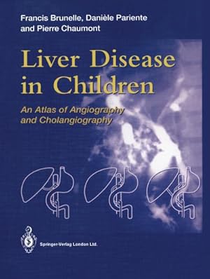 Immagine del venditore per Liver Disease in Children venduto da BuchWeltWeit Ludwig Meier e.K.