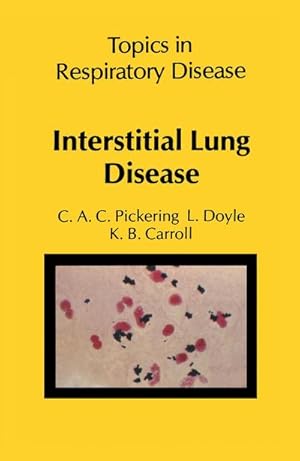 Imagen del vendedor de Interstitial Lung Disease a la venta por BuchWeltWeit Ludwig Meier e.K.