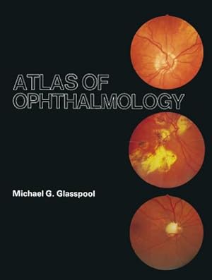 Seller image for Atlas of Ophthalmology for sale by BuchWeltWeit Ludwig Meier e.K.