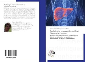 Image du vendeur pour Radiologie interventionnelle et hpatocarcinome mis en vente par BuchWeltWeit Ludwig Meier e.K.
