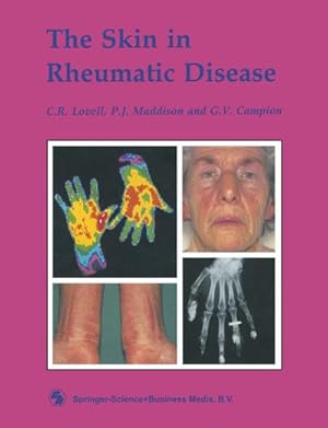 Imagen del vendedor de The Skin in Rheumatic Disease a la venta por BuchWeltWeit Ludwig Meier e.K.