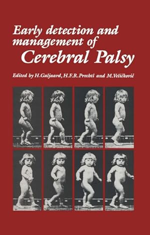 Bild des Verkufers fr Early Detection and Management of Cerebral Palsy zum Verkauf von BuchWeltWeit Ludwig Meier e.K.