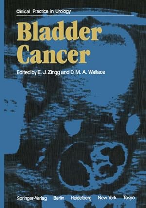 Seller image for Bladder Cancer for sale by BuchWeltWeit Ludwig Meier e.K.