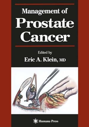 Imagen del vendedor de Management of Prostate Cancer a la venta por BuchWeltWeit Ludwig Meier e.K.