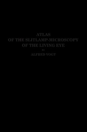 Bild des Verkufers fr Atlas of the Slitlamp-Microscopy of the Living Eye zum Verkauf von BuchWeltWeit Ludwig Meier e.K.