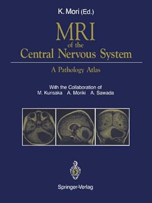 Seller image for MRI of the Central Nervous System for sale by BuchWeltWeit Ludwig Meier e.K.