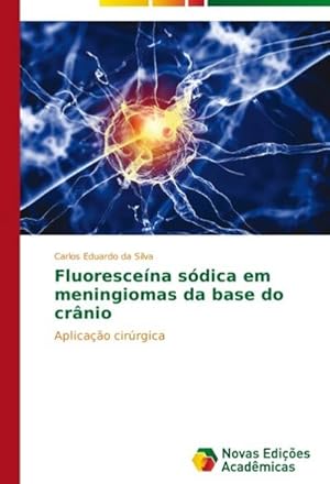 Seller image for Fluorescena sdica em meningiomas da base do crnio for sale by BuchWeltWeit Ludwig Meier e.K.