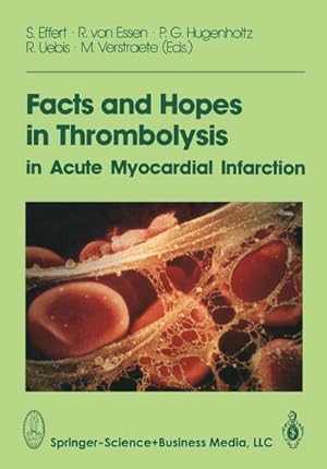 Seller image for Facts and Hopes in Thrombolysis in Acute Myocardial Infarction for sale by BuchWeltWeit Ludwig Meier e.K.