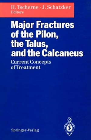 Imagen del vendedor de Major Fractures of the Pilon, the Talus, and the Calcaneus a la venta por BuchWeltWeit Ludwig Meier e.K.