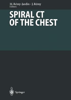 Seller image for Spiral CT of the Chest for sale by BuchWeltWeit Ludwig Meier e.K.