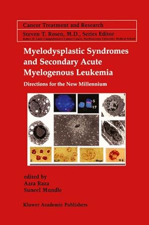 Image du vendeur pour Myelodysplastic Syndromes & Secondary Acute Myelogenous Leukemia mis en vente par BuchWeltWeit Ludwig Meier e.K.