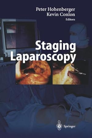 Seller image for Staging Laparoscopy for sale by BuchWeltWeit Ludwig Meier e.K.