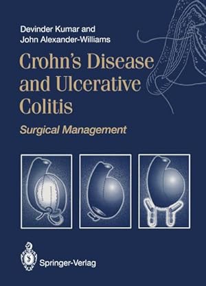 Immagine del venditore per Crohns Disease and Ulcerative Colitis venduto da BuchWeltWeit Ludwig Meier e.K.