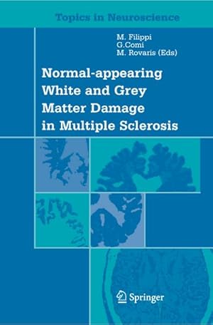 Bild des Verkufers fr Normal-appearing White and Grey Matter Damage in Multiple Sclerosis zum Verkauf von BuchWeltWeit Ludwig Meier e.K.