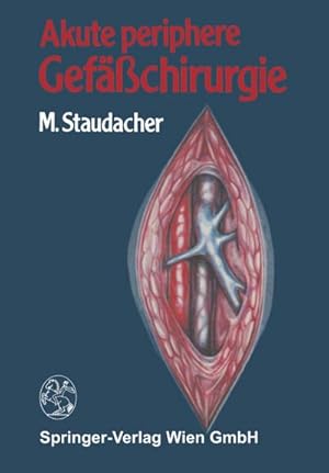Image du vendeur pour Akute periphere Gefchirurgie mis en vente par BuchWeltWeit Ludwig Meier e.K.