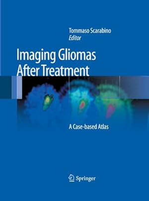 Image du vendeur pour Imaging Gliomas After Treatment mis en vente par BuchWeltWeit Ludwig Meier e.K.