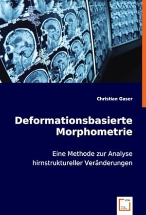 Seller image for Deformationsbasierte Morphometrie for sale by BuchWeltWeit Ludwig Meier e.K.