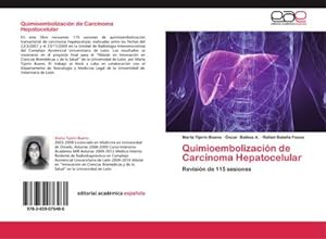 Imagen del vendedor de Quimioembolizacin de Carcinoma Hepatocelular a la venta por BuchWeltWeit Ludwig Meier e.K.