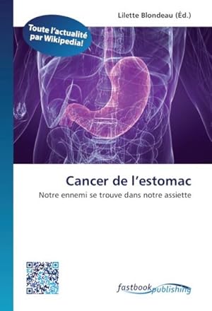 Seller image for Cancer de l'estomac for sale by BuchWeltWeit Ludwig Meier e.K.