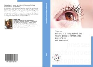 Seller image for Rsultats  long terme des kratoplasties lamellaires profondes for sale by BuchWeltWeit Ludwig Meier e.K.