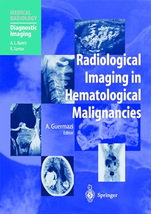 Bild des Verkufers fr Radiological Imaging in Hematological Malignancies zum Verkauf von BuchWeltWeit Ludwig Meier e.K.