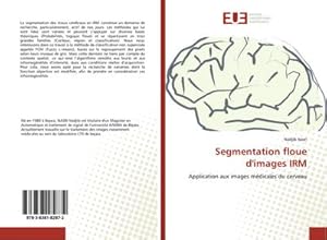 Bild des Verkufers fr Segmentation floue d'images IRM zum Verkauf von BuchWeltWeit Ludwig Meier e.K.