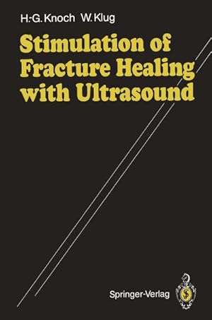 Immagine del venditore per Stimulation of Fracture Healing with Ultrasound venduto da BuchWeltWeit Ludwig Meier e.K.