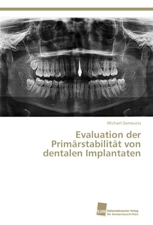 Bild des Verkufers fr Evaluation der Primrstabilitt von dentalen Implantaten zum Verkauf von BuchWeltWeit Ludwig Meier e.K.