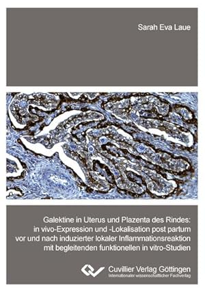 Immagine del venditore per Galektine in Uterus und Plazenta des Rindes. in vivo-Expression und -Lokalisation post partum vor und nach induzierter lokaler Inflammationsreaktion mit begleitenden funktionellen in vitro-Studien venduto da BuchWeltWeit Ludwig Meier e.K.