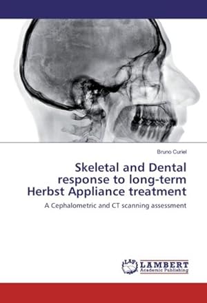 Imagen del vendedor de Skeletal and Dental response to long-term Herbst Appliance treatment a la venta por BuchWeltWeit Ludwig Meier e.K.