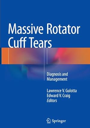 Seller image for Massive Rotator Cuff Tears for sale by BuchWeltWeit Ludwig Meier e.K.