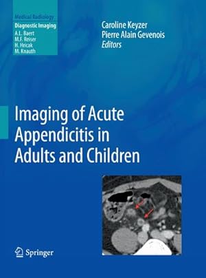 Seller image for Imaging of Acute Appendicitis in Adults and Children for sale by BuchWeltWeit Ludwig Meier e.K.