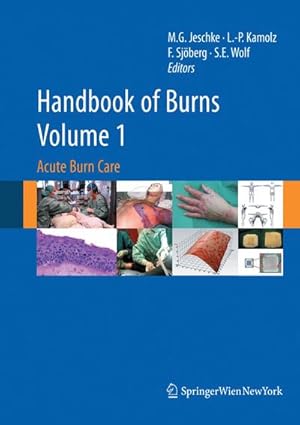 Image du vendeur pour Handbook of Burns Volume 1 mis en vente par BuchWeltWeit Ludwig Meier e.K.