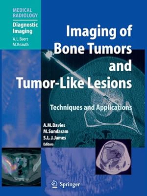 Image du vendeur pour Imaging of Bone Tumors and Tumor-Like Lesions mis en vente par BuchWeltWeit Ludwig Meier e.K.