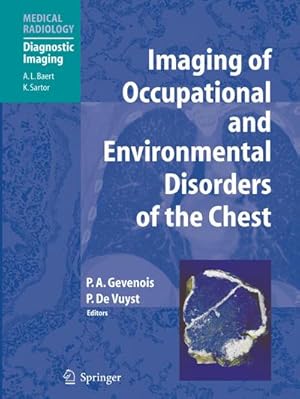 Image du vendeur pour Imaging of Occupational and Environmental Disorders of the Chest mis en vente par BuchWeltWeit Ludwig Meier e.K.