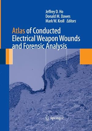 Bild des Verkufers fr Atlas of Conducted Electrical Weapon Wounds and Forensic Analysis zum Verkauf von BuchWeltWeit Ludwig Meier e.K.