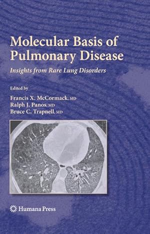 Image du vendeur pour Molecular Basis of Pulmonary Disease mis en vente par BuchWeltWeit Ludwig Meier e.K.