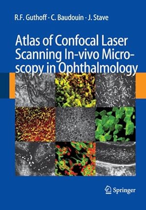 Imagen del vendedor de Atlas of Confocal Laser Scanning In-vivo Microscopy in Ophthalmology a la venta por BuchWeltWeit Ludwig Meier e.K.