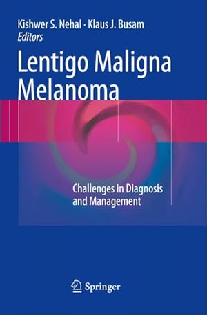 Imagen del vendedor de Lentigo Maligna Melanoma a la venta por BuchWeltWeit Ludwig Meier e.K.